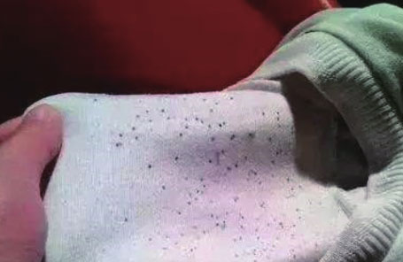Clothing moldy\\Mildew infection